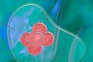 孕期抗炎饮食指南：健康抗炎，营养均衡吃对了！